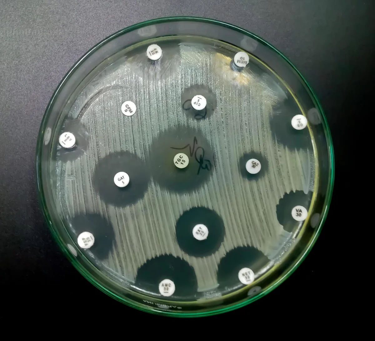 Çocuk yoğun bakımlarında antibiyotik direnci 2035'te kritik eşiği aşabilir